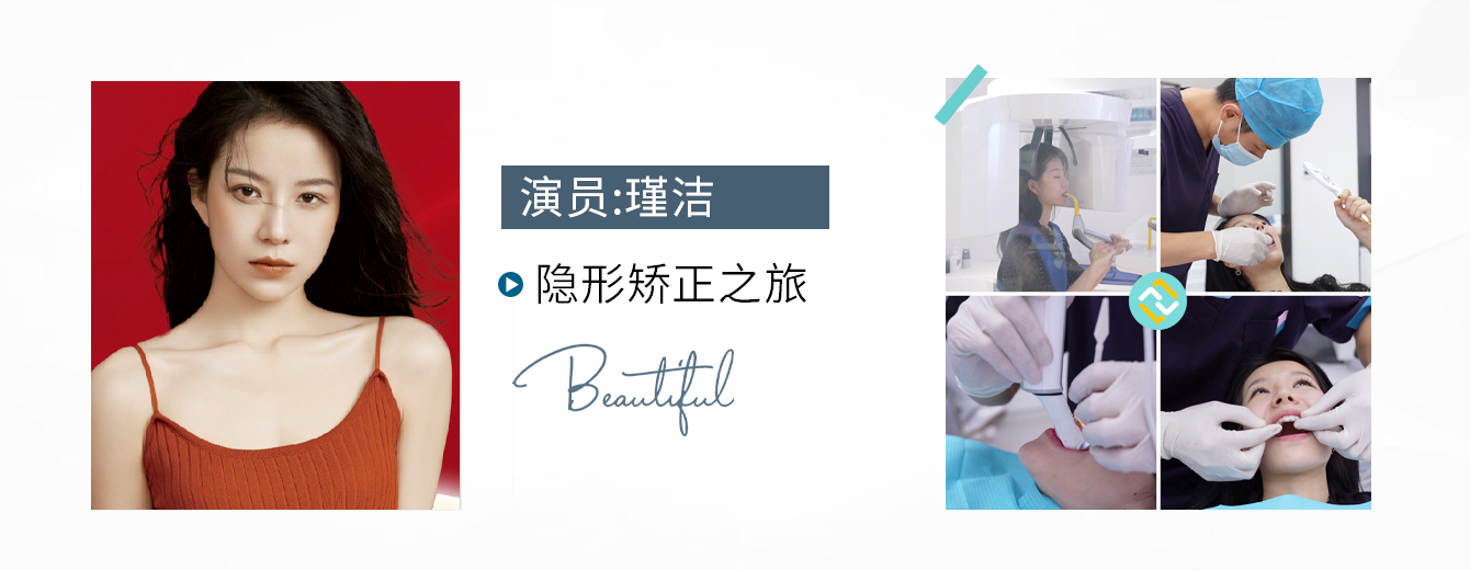 演员瑾洁